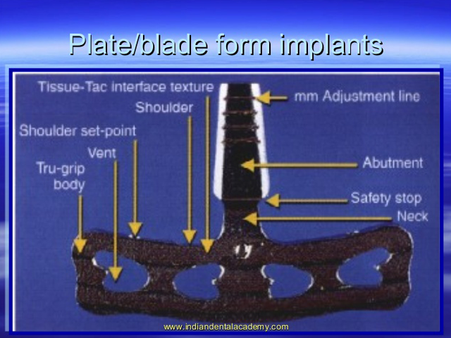 Implant Design